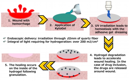 Operation of KytoGEL.jpg